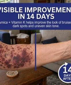 Dobshow® Dark Spot & Bruise Recovery Cream
