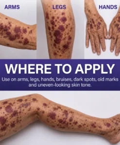 Dobshow® Dark Spot & Bruise Recovery Cream