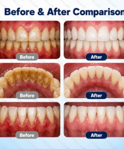 Dobshow® Lipo-Gum™ Advanced Repair Drops