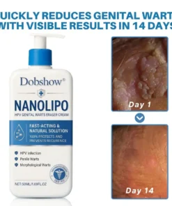 Dobshow® NanoLipo H-P-V Intimate Renewal Cream