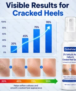 Dobshow® 2% Salicylic Acid Callus & Cracked Heel Spray