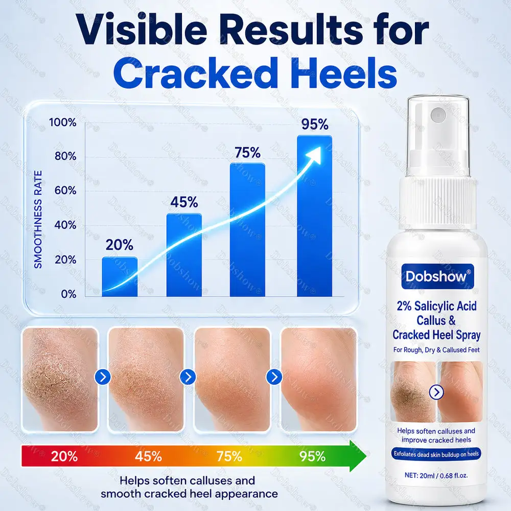 Dobshow® 2% Salicylic Acid Callus & Cracked Heel Spray