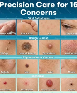 Dobshow® 7 -Day Wart & Blemish Remover