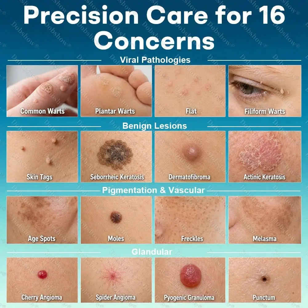 Dobshow® 7 -Day Wart & Blemish Remover