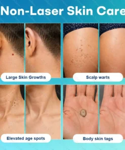 Dobshow® 7 -Day Wart & Blemish Remover