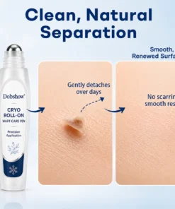 Dobshow® 7 -Day Wart & Blemish Remover