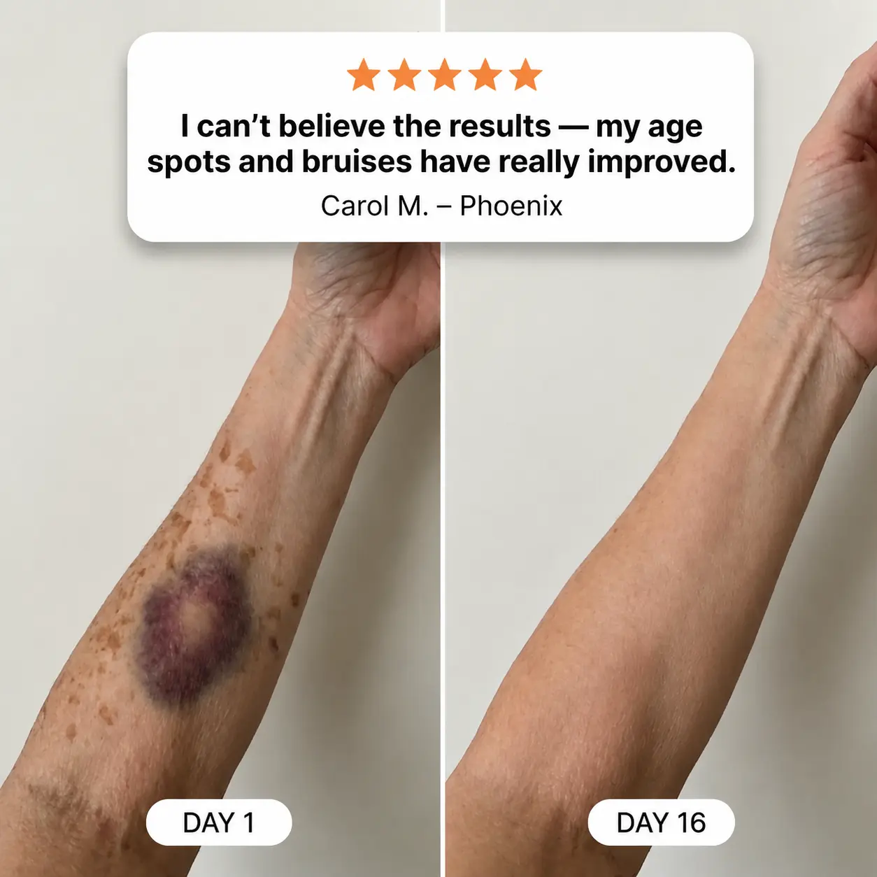 Dobshow® All-New Upgraded Dark Spot Correcting, Bruise Healing & Skin Strengthening Cream