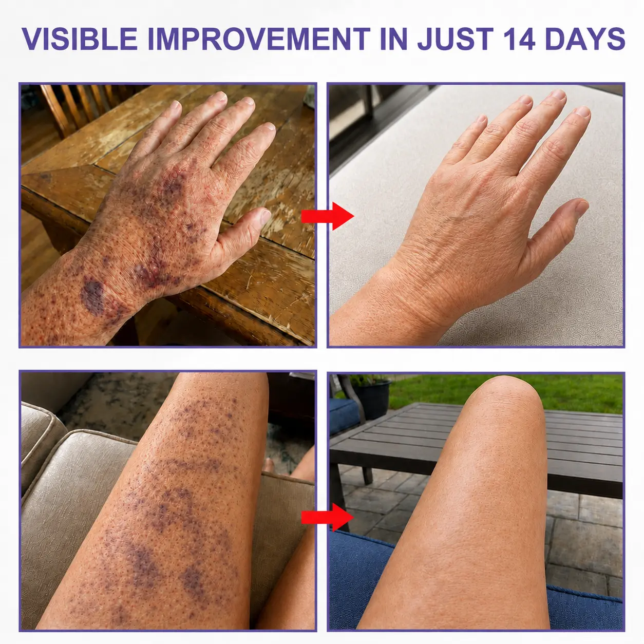 Dobshow® All-New Upgraded Dark Spot Correcting, Bruise Healing & Skin Strengthening Cream