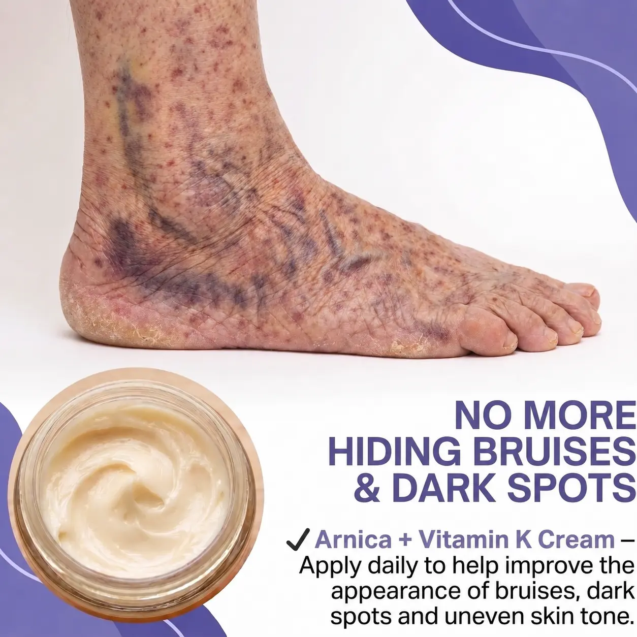 Dobshow® All-New Upgraded Dark Spot Correcting, Bruise Healing & Skin Strengthening Cream