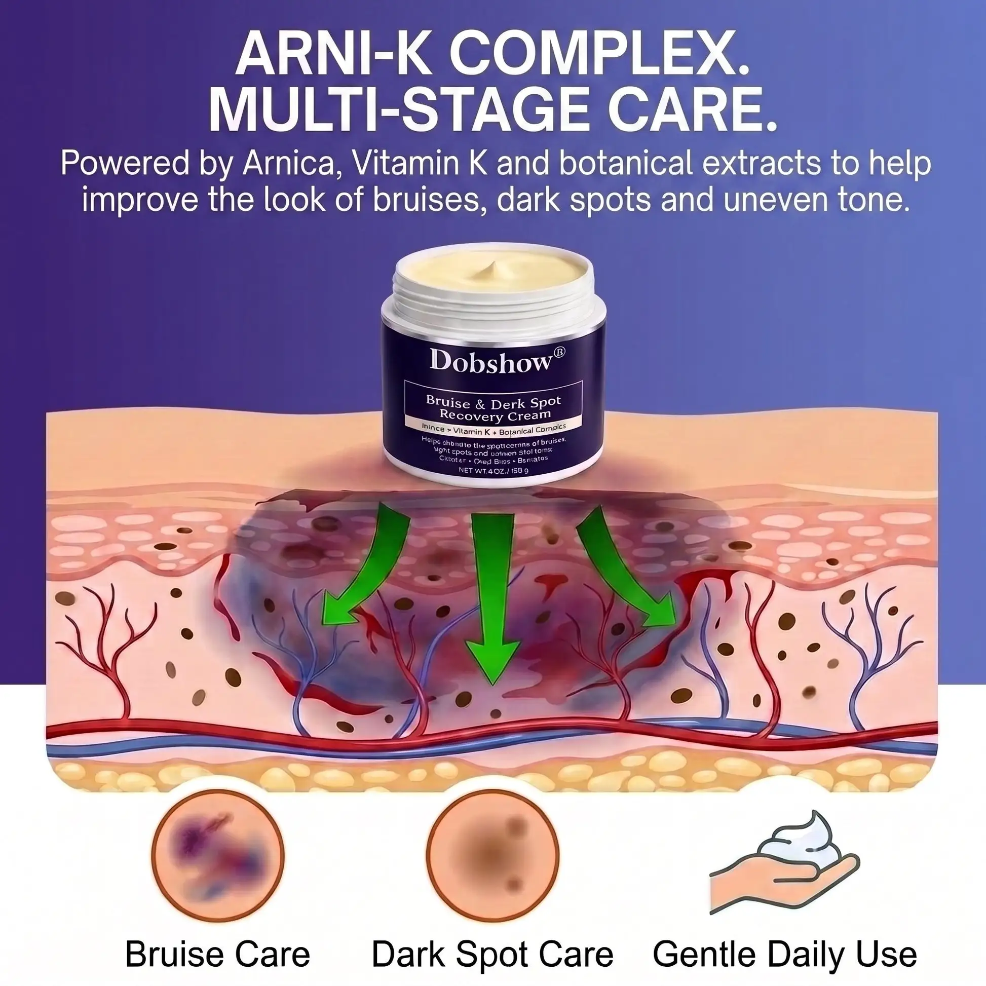 Dobshow® All-New Upgraded Dark Spot Correcting, Bruise Healing & Skin Strengthening Cream