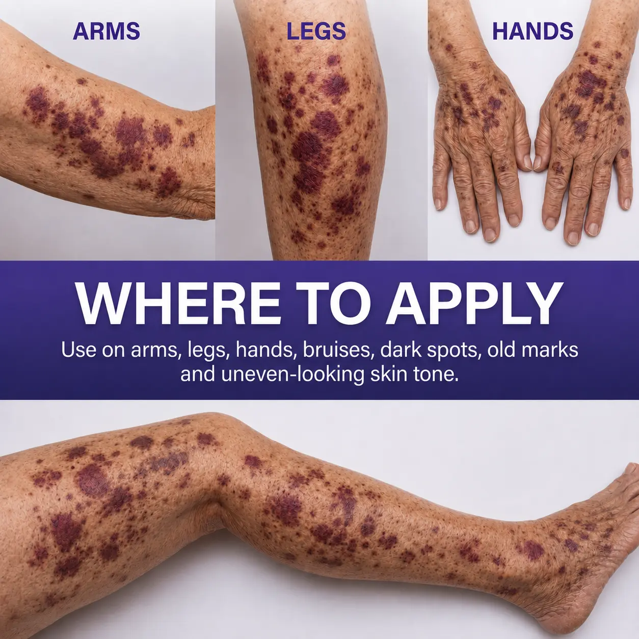 Dobshow® All-New Upgraded Dark Spot Correcting, Bruise Healing & Skin Strengthening Cream