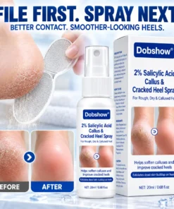Dobshow® Medical-Grade 2% Salicylic Acid Callus & Cracked Heel Repair Spray