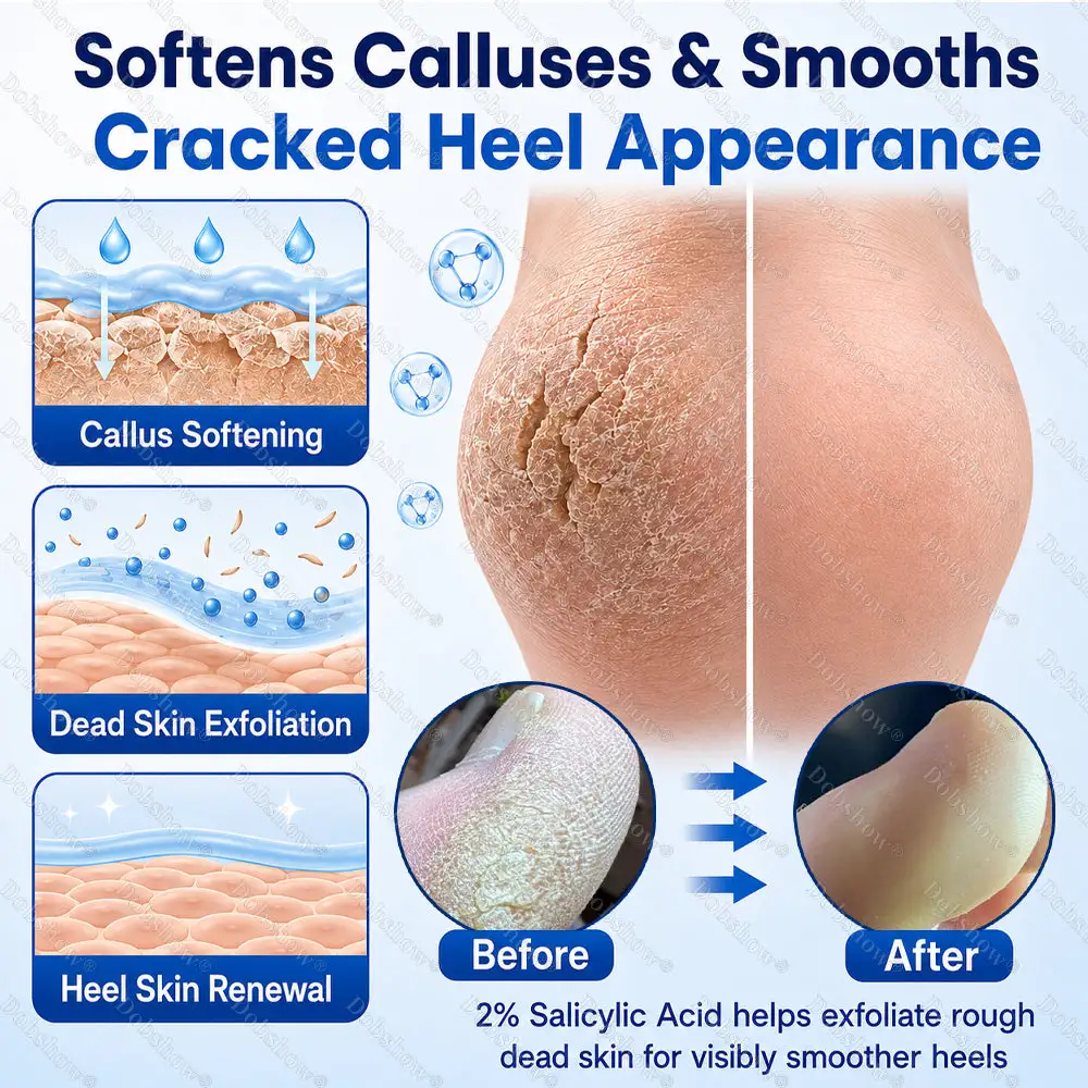 Dobshow® Medical-Grade 2% Salicylic Acid Callus & Cracked Heel Repair Spray