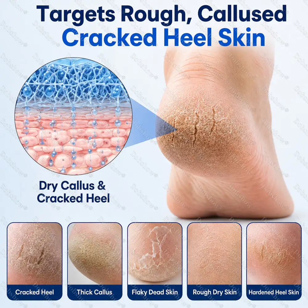 Dobshow® Medical-Grade 2% Salicylic Acid Callus & Cracked Heel Repair Spray