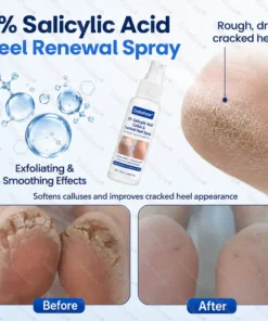 Dobshow® Medical-Grade 2% Salicylic Acid Callus & Cracked Heel Repair Spray