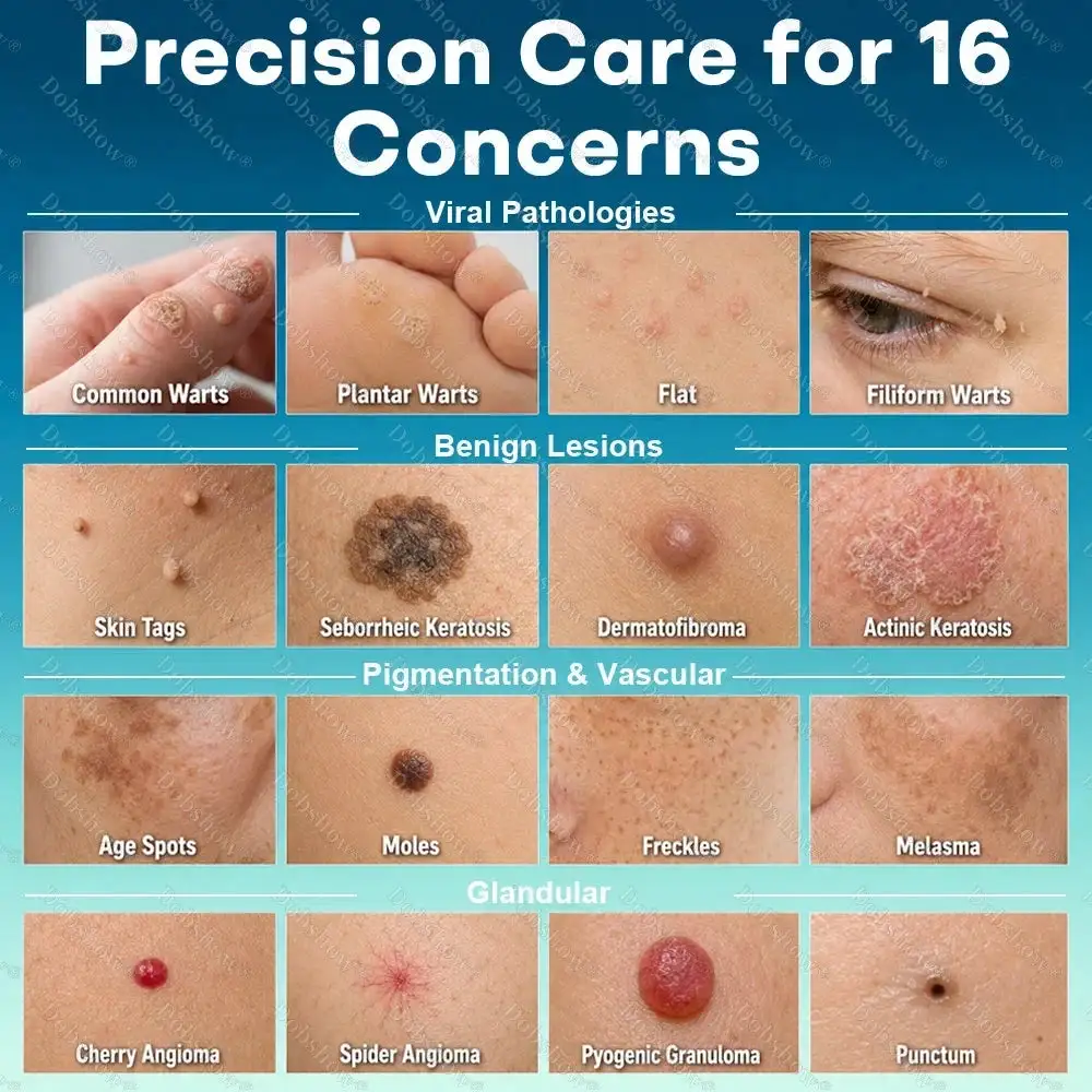 Dobshow® Newly Upgraded Precision Wart & Dark Spot Corrector Pen