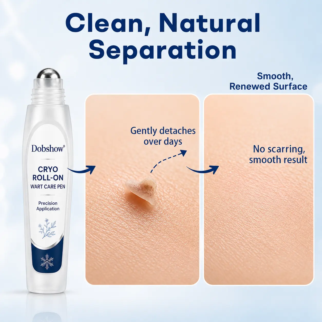 Dobshow® Newly Upgraded Precision Wart & Dark Spot Corrector Pen