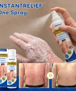 Dobshow® PsoriaClear No-Rub Psoriasis Relief Spray