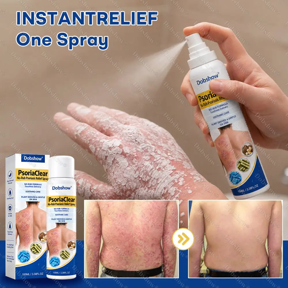 Dobshow® PsoriaClear No-Rub Psoriasis Relief Spray