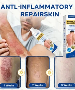 Dobshow® PsoriaClear No-Rub Psoriasis Relief Spray