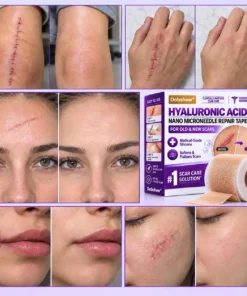 Dobshow® Medical-Grade Nano Microneedle Scar Repair Tape