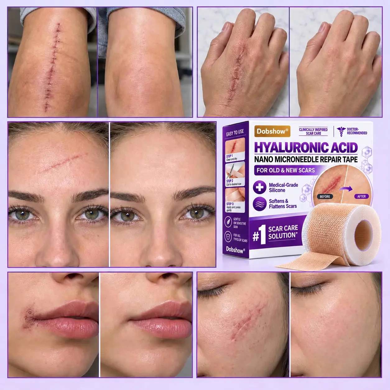 Dobshow® Medical-Grade Nano Microneedle Scar Repair Tape